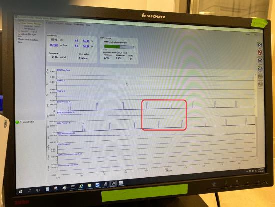 Normal pressure trace.jpg